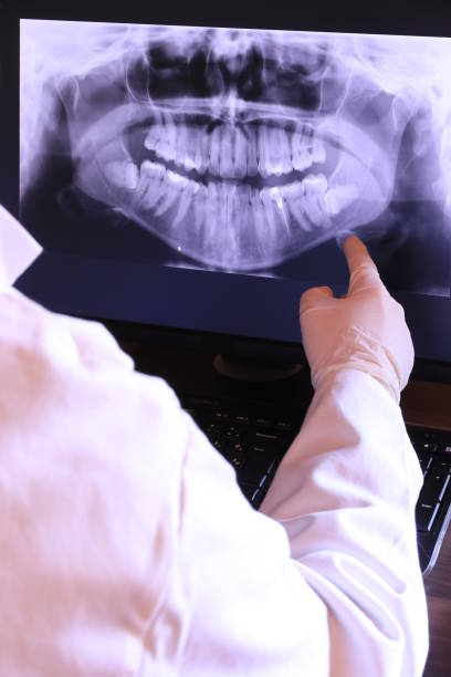 Best Emergency Dental Extractions in Castle Hills, TX