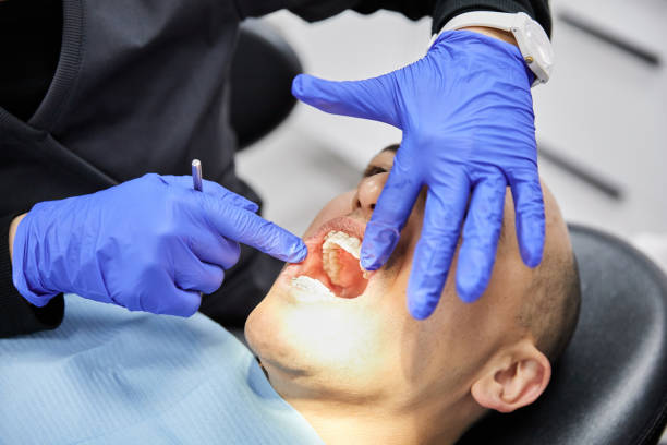 Best Emergency Dental Care for Abscessed Tooth in Castle Hills, TX